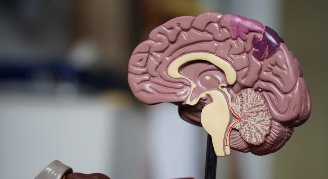 A cross-section model of a human brain